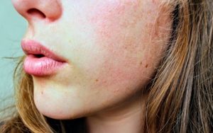 De kracht van selectieve zorg: waarom een persoonlijke benadering telt bij cosmetische behandelingen